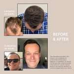 Keeps Hair Regrowth Treatment Mens Shampoo for Fuller, Thicker Looking Hair, 8 oz - Thinning and Hair Growth Shampoo for Men - DHT Blocker - Infused with Biotin, Caffeine, & Saw Palmetto