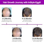 InStyle-Egg 272 Pro Max Laser Cap for Hair Regrowth | FDA Cleared Laser Hair Growth Device | Red Light Therapy, Hair Loss Treatment for Men and Women.