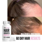 St. Tropica Tru Bloom Hair Growth Vitamins - 2 Month Supply. Clinically Proven for Fuller, Thicker Hair. Natural & Drug-Free. Ultimate Hair Vitamins for Proven Results