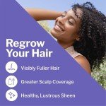 Shapiro MD Hair Growth Experts Minoxidil 2% Topical Solution for Women, Serum Promotes Hair Regrowth by Reactivating Hair Follicles (1 Month)