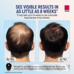 Taro Minoxidil Topical Aerosol Foam, 5%, Hair Regrowth Treatment for Men, 2.11 oz