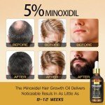 5% Minoxidil Hair Growth Serum Oil For Men and Women, Biotin Hair Serum, Safest Hair Regrowth Treatment, Prevent Scalp Hair Loss 60ml / 2.11 fl.oz