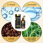 5% Minoxidil Hair Growth Serum Oil For Men and Women, Biotin Hair Serum, Safest Hair Regrowth Treatment, Prevent Scalp Hair Loss 60ml / 2.11 fl.oz