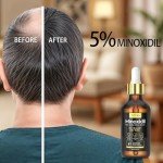 5% Minoxidil Hair Growth Serum Oil For Men and Women, Biotin Hair Serum, Safest Hair Regrowth Treatment, Prevent Scalp Hair Loss 60ml / 2.11 fl.oz