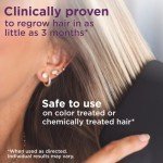 Amazon Basic Care Hair Regrowth Treatment For Women, Minoxidil 5%, Topical Aerosol (Foam), Unscented, 2 Month Supply, 2.11 ounce (Pack of 1)