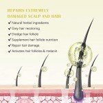 5% Minoxidil Hair Growth Oil for Men and Women - Regrowth Serum, Extra Strength Spray for Hair Loss, Thicker Healthier Hair, Beard Growth Kit, Topical Treatment, 2.02 oz