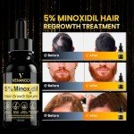 5% Minoxidil for Men Hair Growth Oil: Hair Regrowth Treatment for Scalp Hair Loss & Beard - Hair Growth Serum for Thicker, Longer, Fuller, Healthier Hair