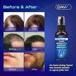 Hair Growth Serum with 5% Minoxidil, 2 fl oz, Hair Thickening Treatment for Men and Women
