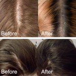 Aphrona® Advanced Hair Growth System 272 HairPro for Men and Women I For Mild to Moderate Hair Loss I Rechargeable Laser Cap for Hair Regrowth I Clinically Proven I FDA Cleared for Men and Women