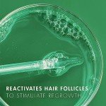 Nexxus Minoxidil Topical Solution 2% Hair Regrowth Treatment 2 oz