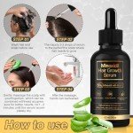 5% Minoxidil Hair Growth for Men and Women, Minoxidil Hair Growth Serum, Promotes Hair Growth, Strengthens Hair Follicles, Helps Prevent Hair Fall and Hair Loss