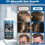 5% Minoxidil for Men Women, 100ML Minoxidil Hair Growth, Hair Regrowth Treatment Spray, Minoxidil Topical Solution Hair Growth Serum Stop Thinning and Loss Hair 2 Month Supply, for Beard, Hair