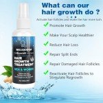 5% Minoxidil for Men Women, 100ML Minoxidil Hair Growth, Hair Regrowth Treatment Spray, Minoxidil Topical Solution Hair Growth Serum Stop Thinning and Loss Hair 2 Month Supply, for Beard, Hair