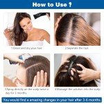 5% Minoxidil for Men Women, 100ML Minoxidil Hair Growth, Hair Regrowth Treatment Spray, Minoxidil Topical Solution Hair Growth Serum Stop Thinning and Loss Hair 2 Month Supply, for Beard, Hair