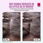 Taro Minoxidil Topical Aerosol Foam, 5%, Hair Regrowth Treatment for Women, 2.11 oz (2 Months Supply) Reactivates Hair Follicles to Stimulate Hair Regrowth