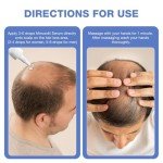 5% Minoxidil for Men Hair Growth Serum - Minoxidil for Women Serum with Biotin for Thicker & Healthier, Topical Minoxidil for Men Restore Fuller Beard & Hair Growth Oil Unisex 3.38 FL OZ for 3 Months