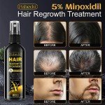 5% Minoxidil for Men and Women Hair Growth Serum - Castor Oil & Biotin Hair Growth Spray Hair Regrowth Treatment for Scalp Hair Loss Hair Thinning For Thicker Longer Fuller Healthier Hair 100Ml