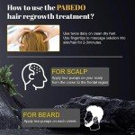 5% Minoxidil for Men and Women Hair Growth Serum - Castor Oil & Biotin Hair Growth Spray Hair Regrowth Treatment for Scalp Hair Loss Hair Thinning For Thicker Longer Fuller Healthier Hair 100Ml