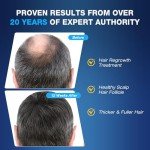 5% Minoxidil for Men Foam Hair Growth - Minoxidil Foam Hair Regrowth Treatment for Men, Topical Hair Loss Treatments, Extra Strength Thicker & Fuller Hair, 1 Month Supply, 2.11 oz