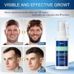 Minoxidil for Men Hair Growth Spray - 5% Topical Hair Regrowth Treatment for Thinning Hair and Beard Growth, Extra Strength Hair Loss Solution (2 Pack)