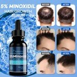 5% Minoxidil Hair Growth for Men and Women: Extra Strength Minoxidil Hair Loss Treatment Serum with Boitin for Faster Stronger Thicker Hair Growth, 4 FL OZ/120 ML