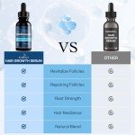 5% Minoxidil Hair Growth for Men and Women: Extra Strength Minoxidil Hair Loss Treatment Serum with Boitin for Faster Stronger Thicker Hair Growth, 4 FL OZ/120 ML