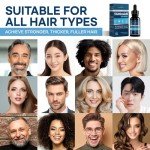 5% Minoxidil Hair Growth for Men and Women: Extra Strength Minoxidil Hair Loss Treatment Serum with Boitin for Faster Stronger Thicker Hair Growth, 4 FL OZ/120 ML