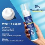 Minoxidil Foam, 5% Topical Minoxidil Foam, Minoxidil for Men and Women, Infused with Biotin, Hair Growth Treatment, Supports Thicker and Fuller Hair & Beard (Minoxidil Foam, 6.33oz, 3 Month Supply)