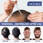 5% Minoxidil for Men and Women, Hair Regrowth Treatment for Thinning Hair and Hair Loss, Topical Solution - 2 Months Supply - Dermatologist recommended (Pack of 2)