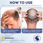 5% Minoxidil for Men and Women, Hair Regrowth Treatment for Thinning Hair and Hair Loss, Topical Solution - 2 Months Supply - Dermatologist recommended (Pack of 2)