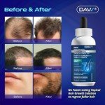 Minoxidil for Men Hair Growth Serum: Minoxidil 5 Percent with Biotin - Hair Regrowth for Men - Beard Growth Serum - Hair Loss Treatments - Minoxidil 5% - Faster Stronger Thicker Hair Growth - 60ml