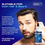 Minoxidil for Men Hair Growth Serum: Minoxidil 5 Percent with Biotin - Hair Regrowth for Men - Beard Growth Serum - Hair Loss Treatments - Minoxidil 5% - Faster Stronger Thicker Hair Growth - 60ml