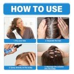 rubvil 5% Μiпοxidīl for Men and Women, Hair Growth Serum Spray for Stronger, Thicker and Longer Hair Regrowth, Hair Loss and Thinning Hair Loss Treatment