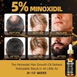 2-Pack 5% Minoxidil Hair Growth Serum for Men and Women, Hair Regrowth Treatment for Stronger, Thicker, and Longer Hair, Facial Hair Grooming and Thickening Solution
