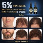 5% Minoxidil with Biotin for Men Spray, Minoxidil with Rosemary for Women Hair Growth, Beard Scalp Serum for Thicker Fuller Hair (2 x 2 Fl Oz)
