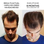 Laser Hair Growth Cap, Laser Hair Growth Cap is Low Level Laser Therapy (LLLT) Device Designed to Promote Hair Growth in Women and Men, Laser Cap Red Light Therapy Cap Laser Therapy Cap