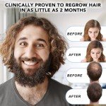 Minoxidil for Men-5% Extra Strength Hair Regrowth for Men Treatment-5% Topical Solution-Dropper Applicator Included -Minoxidil for Women-Stop Thinning & Hair Loss (1pcs)