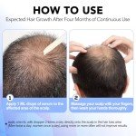 Minoxidil for Men-5% Extra Strength Hair Regrowth for Men Treatment-5% Topical Solution-Dropper Applicator Included -Minoxidil for Women-Stop Thinning & Hair Loss (1pcs)