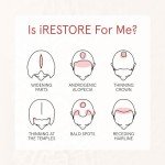 iRESTORE Biotin Hair Conditioner for Damaged Dry Hair - Biotin Conditioner for Fine Hair Growth, Volumizing Thickening Conditioner with Ginseng & Argan Oil to Moisturize, Pair With Hair Loss Shampoo