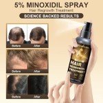 Minoxidil Spray - 5% Minoxidil for Men, Minoxidil for Women Hair Growth Products, Extra Strength Hair Regrowth Treatments with Biotin, Help to Stop Loss Hair Unscented Light and non Greasy 3.38 Fl.OZ