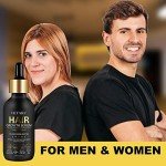 5% Minoxidil for Men and Women - Biotin Hair And Beard Growth Serum & 5% Minoxidil Treatment for Stronger Thicker Longer – Natural Growth Thickening Treatment - Stop Thinning & Hair Loss-1Month supply
