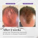 Dr. Groot Hair Thickening Shampoo, Korean Hair Care with Biotin, Rosemary Oil to Help Volumize Thinning, Damaged Hair, Hydrate Hair and Scalp, Biotin Shampoo, Scalp Revitalizing Solution