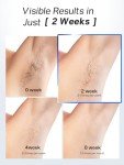 Blex Laser Hair Removal for Women and Men, IPL Laser Hair Removal Device with Permanent Results, Effective in 2 Weeks, Ultra-Fast 0.2s Light Emission, Painless at-home Hair Remover