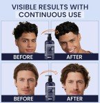 Biotin Hair Growth Conditioner for Men: Natural Thickening and Volumizing Conditioner with Tea Tree Oil Ginseng Mint for Hair Loss and Thinning Hair - 10.1 fl.oz, Dark Blue