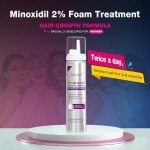 2% Minoxidil for Women Foam Hair Growth - Minoxidil Hair Regrowth Treatment for Women, Topical Solution Hair Loss Treatments, Thicker and Fuller Hair, 2 x 2.11 oz for 2 Months Use