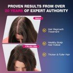 2% Minoxidil for Women Foam Hair Growth - Minoxidil Hair Regrowth Treatment for Women, Topical Solution Hair Loss Treatments, Thicker and Fuller Hair, 2 x 2.11 oz for 2 Months Use