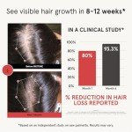 iRESTORE Hair Growth Supplement - Hair Loss Vitamins for Women and Men - Has Biotin Multivitamins & DHT Blocker to Reduce Hair Thinning - Hair Regrowth Pills for Thicker Fuller Volume - 30 Days Supply