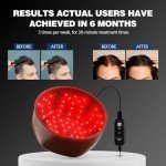 Jitesy Laser Cap, Laser Red Light Therapy for Hair Growth System - FDA Cleared Hair Loss, Hair Thinning & Alopecia Treatment for Men & Women