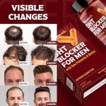 DHT Blocker for Men | Hair Growth Supplement with Saw Palmetto & Biotin - Hair Growth Vitamins - Hair Regrowth - Natural Hair Loss Supplements Liquid-Filled - Proprietary Herbal Blends (90 Capsules)