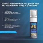 5% Minoxidil for Men and Women, Hair Growth Biotin Serum with Batana and Rosemary for Hair beard Regrowth Treatments, Extra Strength Hair Loss Solution, Clinically Proven to Regrow Thicker, 2.02FL OZ